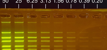 agarose gel stained with SeeGreen showing different masses of DNA in each lane