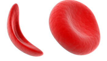 Sickle Cell Front image