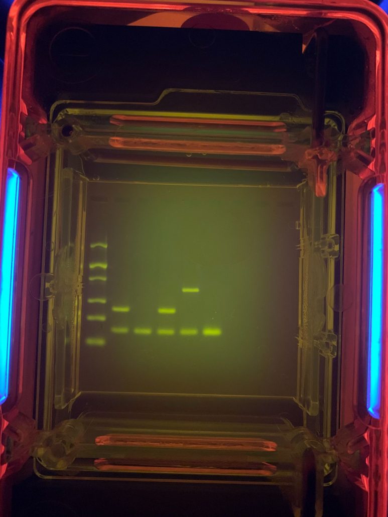 DNA bands on a gel