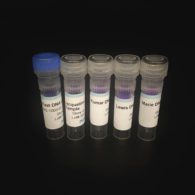 Sickle Cell Genetics Lab: Diagnosing Baby Marie™ – miniPCR bio